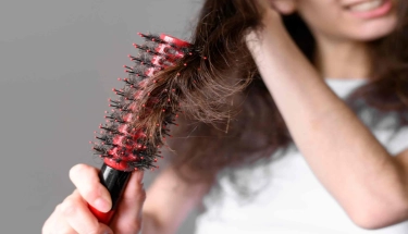  অতিরিক্ত চুল পড়ছে? ঘরোয়া ও প্রাকৃতিক উপায়ে পেতে পারেন কার্যকর সমাধান