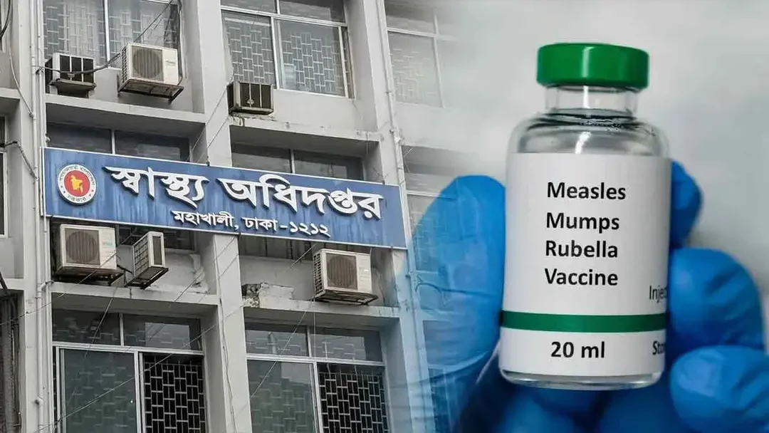 হামের উপসর্গে আরও ৭ শিশুর মৃত্যু, এক দিনে আক্রান্ত ১,০৩১