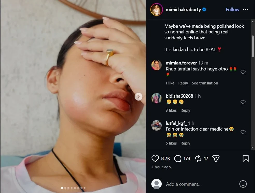অসুস্থতায় চেহারা বদল, কী হয়েছে ‘দুষ্টু কোকিল’ মিমির